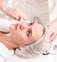 Facial Skin Treatment