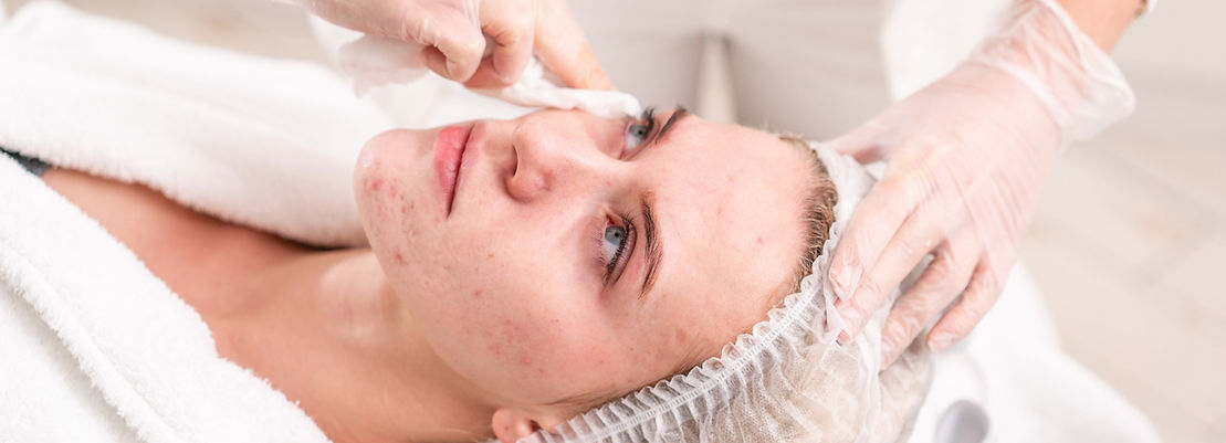 Facial Skin Treatment