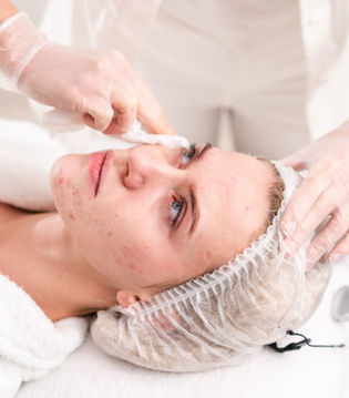 ANTIACNE