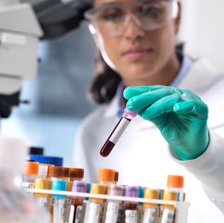 ApoB & Lp(a): The Heart Tests Every Woman Over 40 Needs