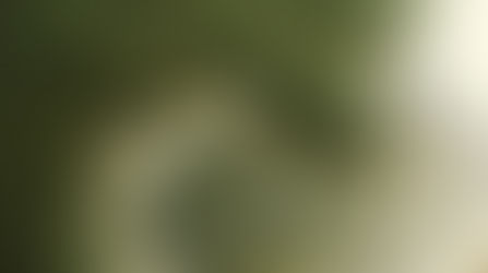 Goldilocks Pain Syndrome: The Struggle to Find “Just Right” Comfort in Inflammatory Arthritis