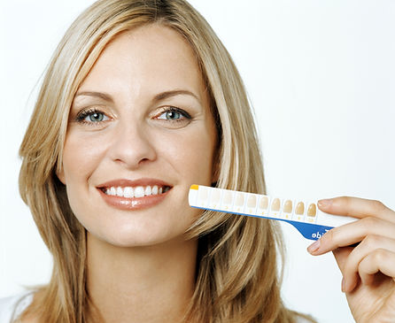 Woman holding up tooth whitening chart