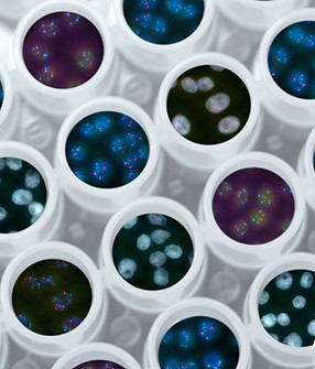 Análisis microscópico de células