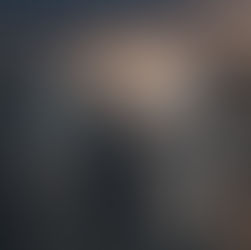 auxílio-acidente no inss, auxílio-acidente, acidente de trabalho, benefício previdenciário, direito previdenciário