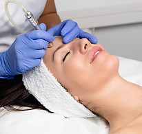 Diamant Microdermabrasion