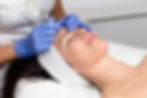 Woman is getting Microdermabrasion treatment in Vancouver