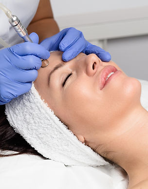 Microdermabrasion treatment at Madrone Beauty
