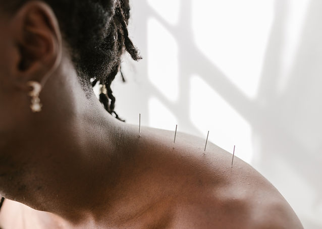 Dry Needling Charlotte NC