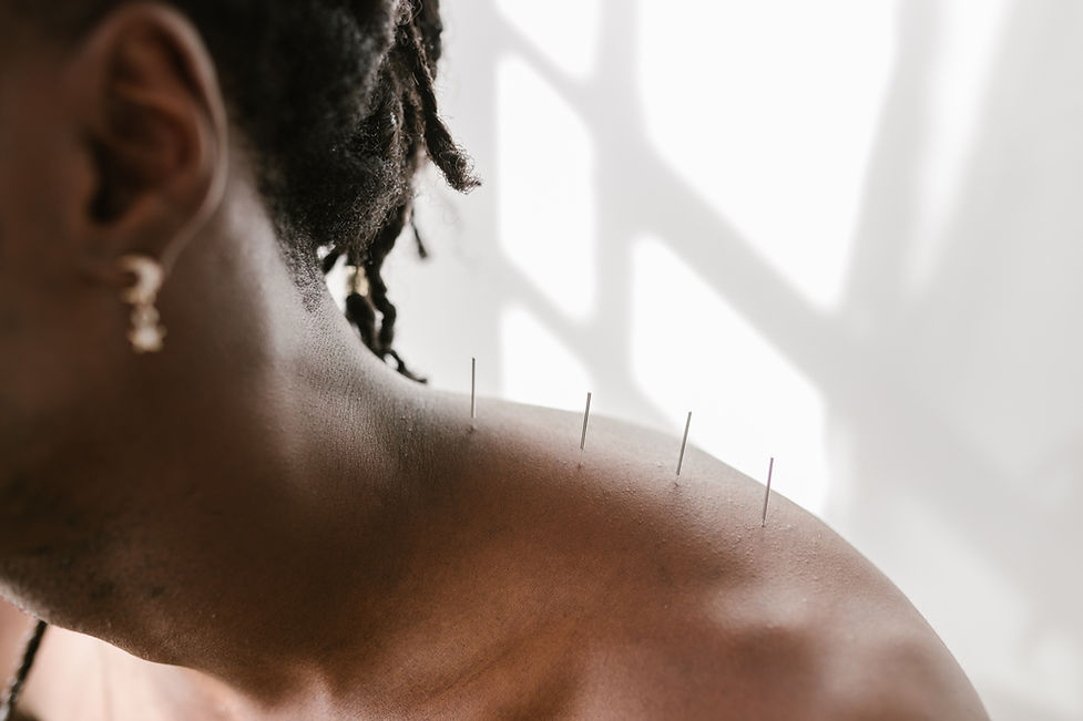 Dry Needling COPE PT