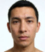 Man with Acne