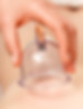 Cupping