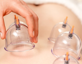 Cupping therapie bij Twistt in Geistingen