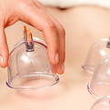 Cupping