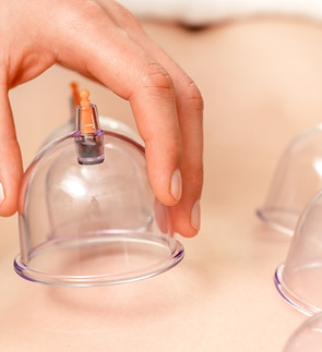 Cupping