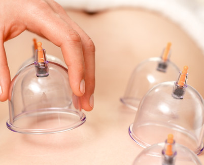 Cupping