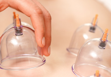 Cupping