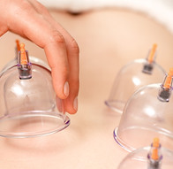 Cupping