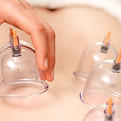 Cupping