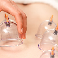 Cupping