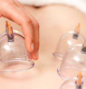 Cupping