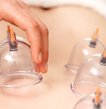 Cupping