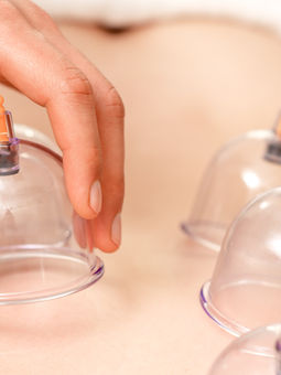 Cupping