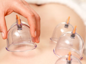 Cupping therapie