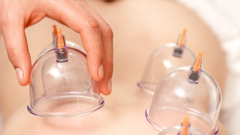 טיפול כוסות רוח לשיכוך כאב בראשון לציון { מרפאת אלף לילה