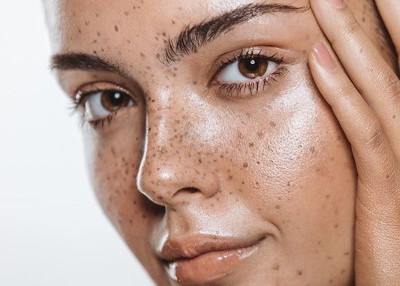 Woman with Freckles