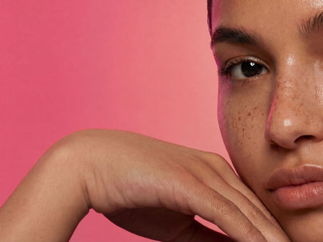 Microneedling for Acne Scars in Flagstaff, AZ:Why Altitude Affects Results