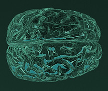 Illustration du cerveau