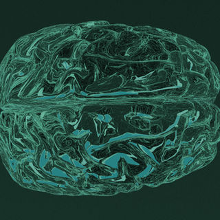 Russian scientists devise a way to restore brain cells