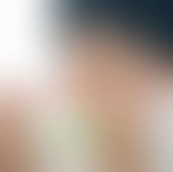 Co je tupozrakost (amblyopie)?