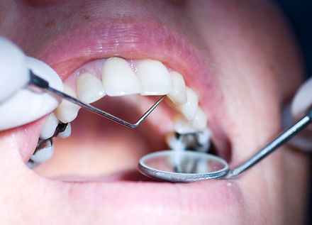patient having a dental examination