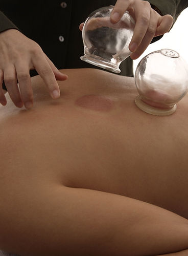 Traitement de ventouses