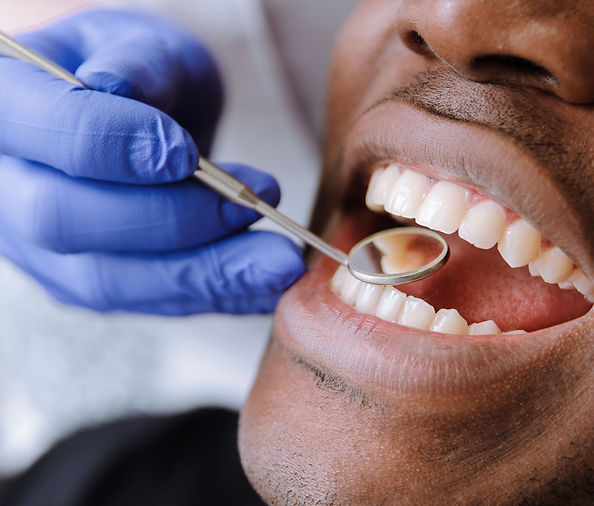 Tooth Exam