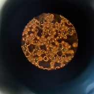 Мікроскопічний вигляд