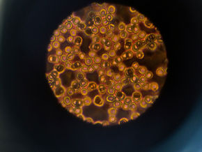 cellule humaine vue au microscope
