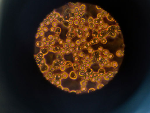 Fertilization Methods: IVF vs. ICSI
