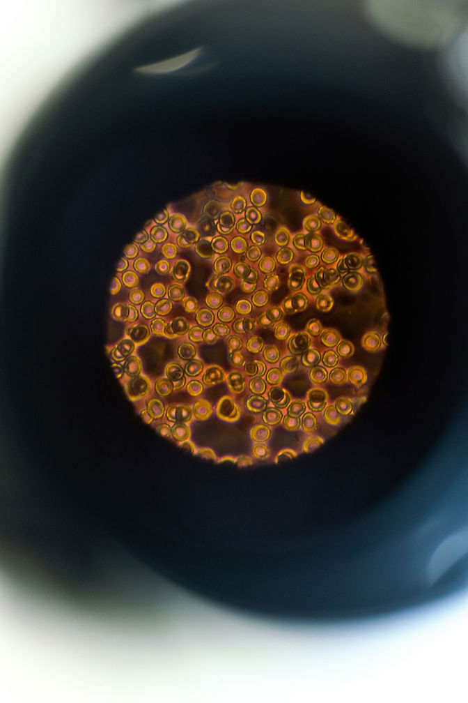 Vista microscópica