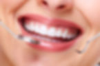 Beautiful woman smile. Dental health care clinic