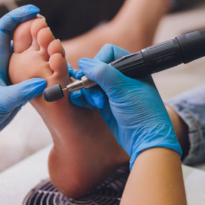 Person using an electric foot file to smooth dry, cracked heels.
