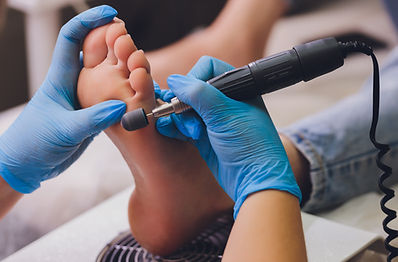 filing hard skin callus off feet professional service