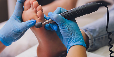 Pedicure