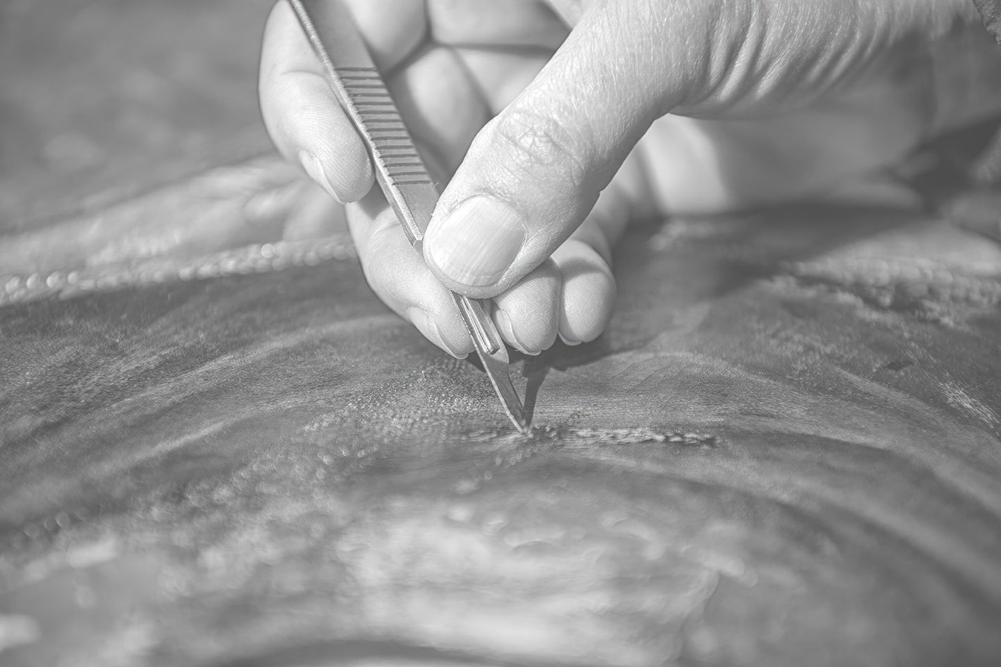 Restorer Using Scalpel