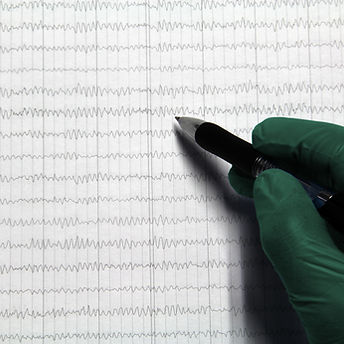 Brain Bioelectric Activity