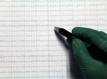 Brain Bioelectric Activity