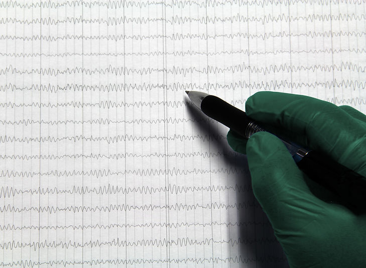 Actividad bioeléctrica del cerebro