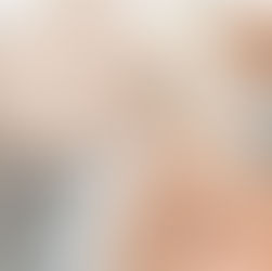 Person receiving a botox injection in the forehead by gloved hands. Close-up, serene setting, white cap on head.