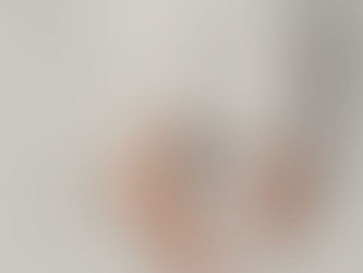 Why I Quit Wearing Open-Toed Shoes